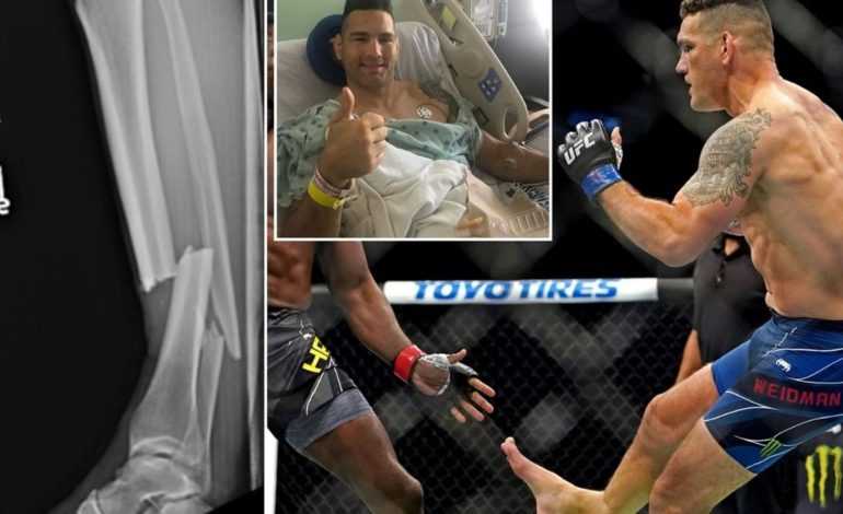  Weidman May Be Done! Having Issues With Recovery?